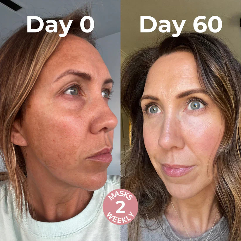 Overnight Collagen Skin Peel