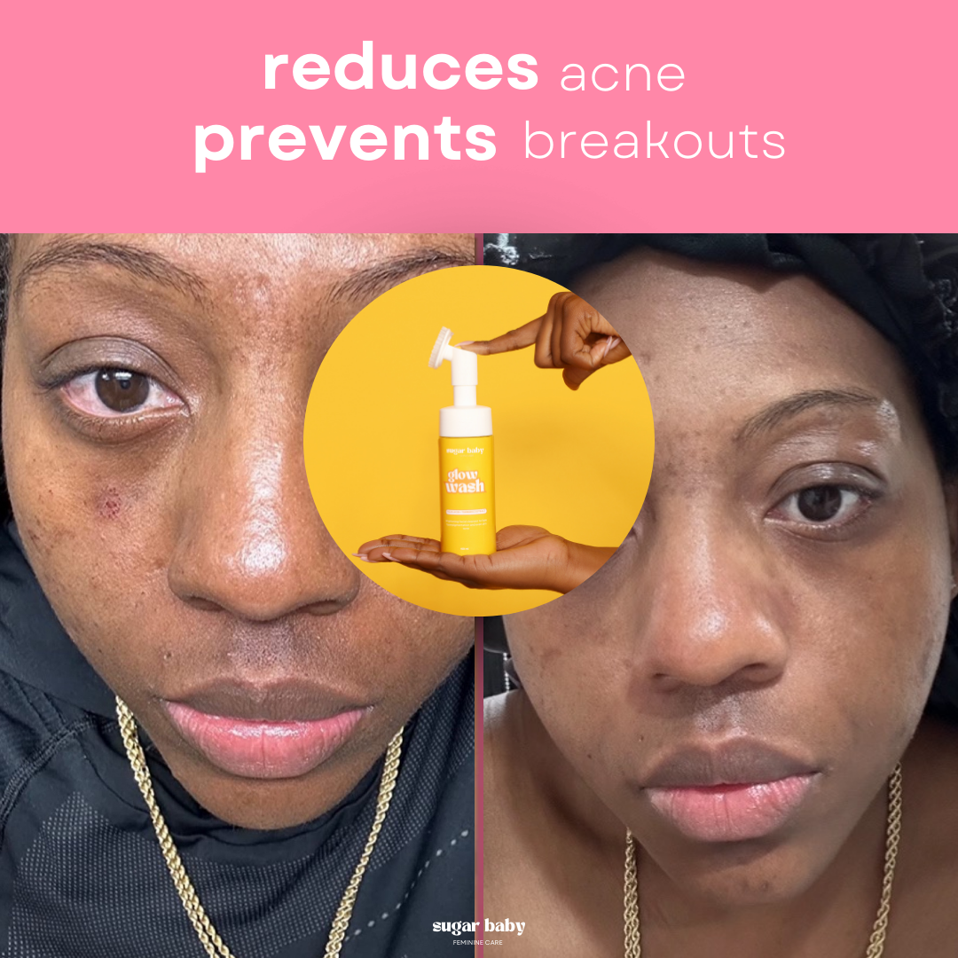 VIRAL Turmeric & Kojic Acid Wash