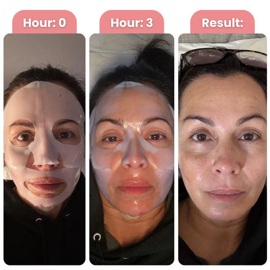The same person at hour 0 with the mask on, hour 3 as it turns clear, and the result the next morning