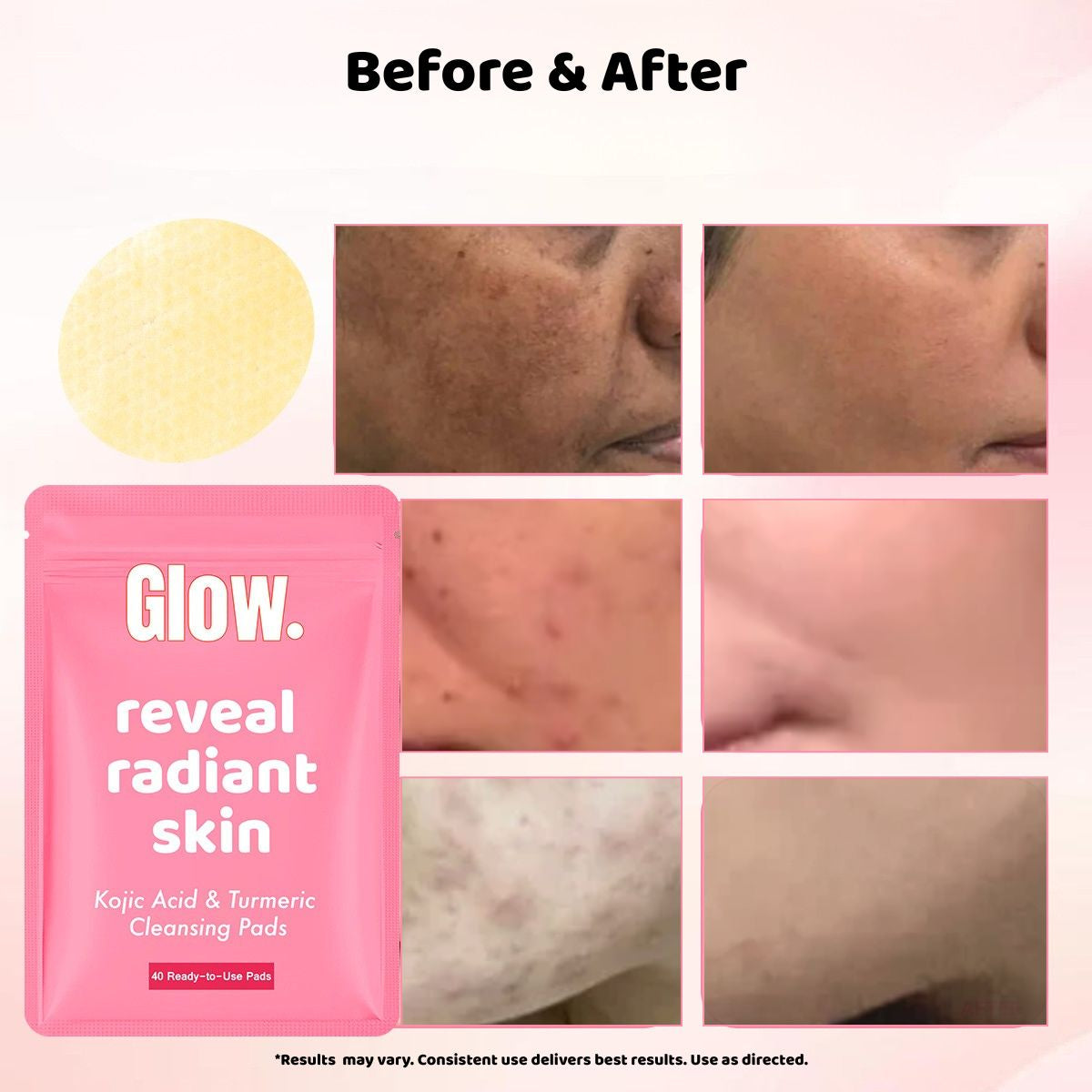 [BUNDLE] Kojic and Turmeric Wash & Pads