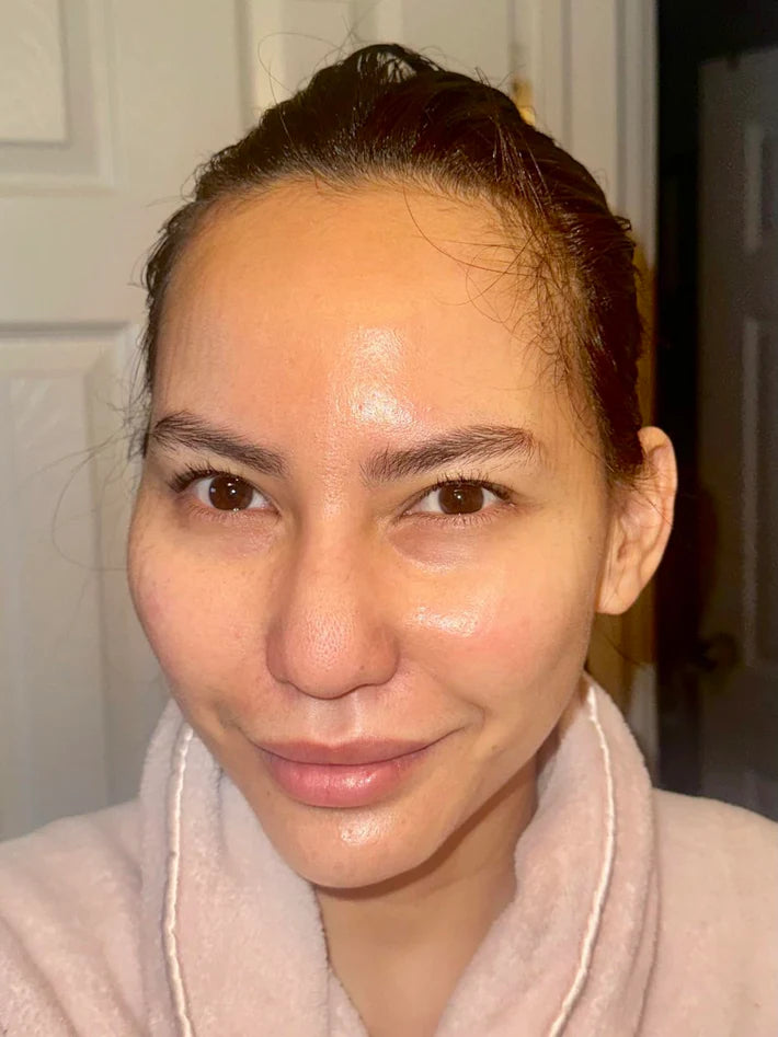 Customer photo from Sydney V. after using the mask