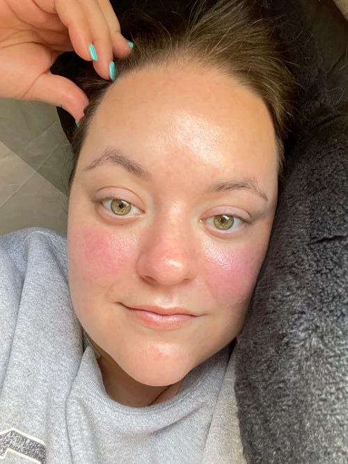 Customer photo from Lana H. after using the mask
