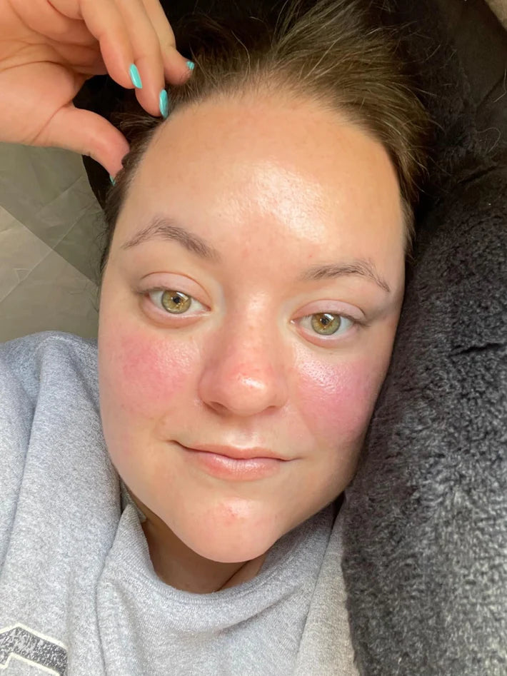 Customer photo from Lana H. after using the mask